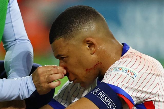 Gawat! Kylian Mbappe Dibawa ke Rumah Sakit Menggunakan Ambulans Usai Laga Perdana Euro 2024, Ada apa?